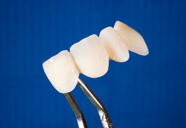 What influences denture repair cost and choosing value in Brisbane
