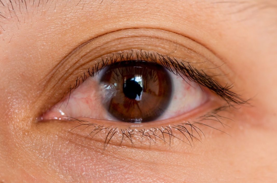 Clear, practical guidance on removing pterygium and choosing eye surgery options