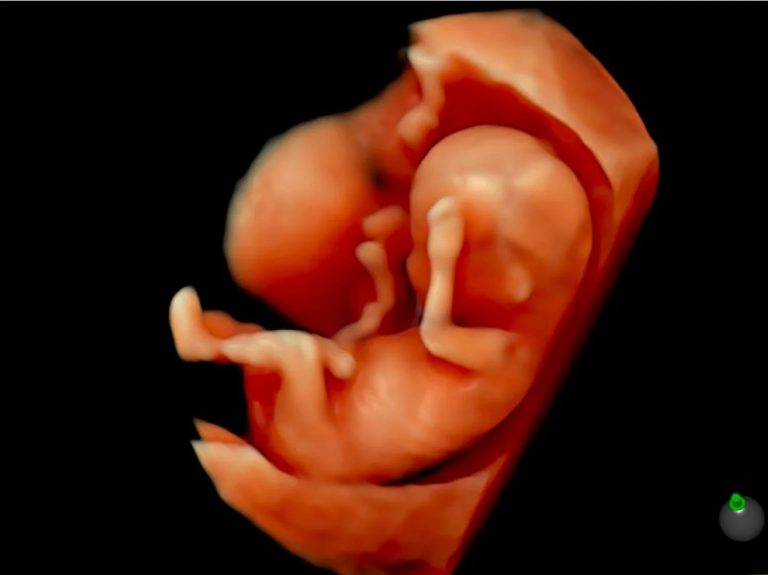 Bright, clear Ultrasound moments you’ll remember