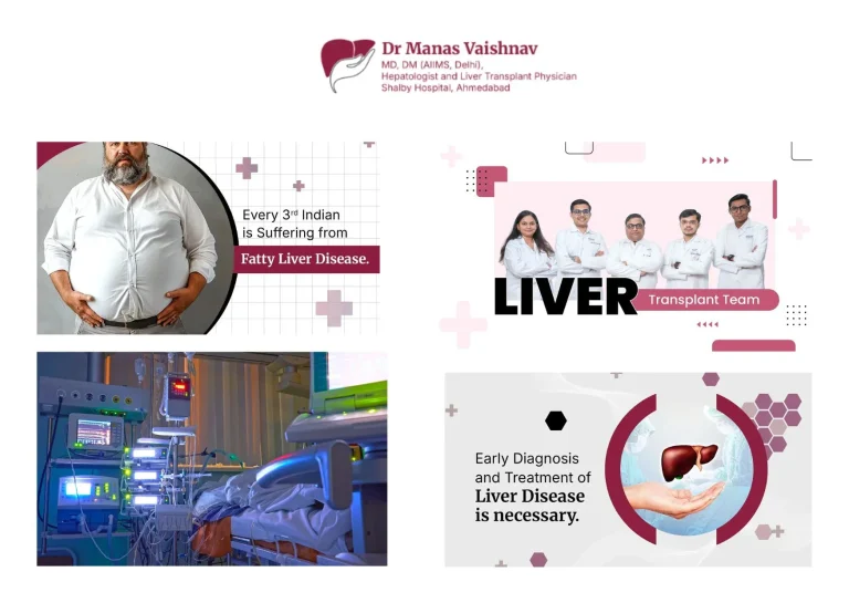 Top Hepatologist in Ahmedabad | Expert Liver Care at Drmanasvaishnav.com