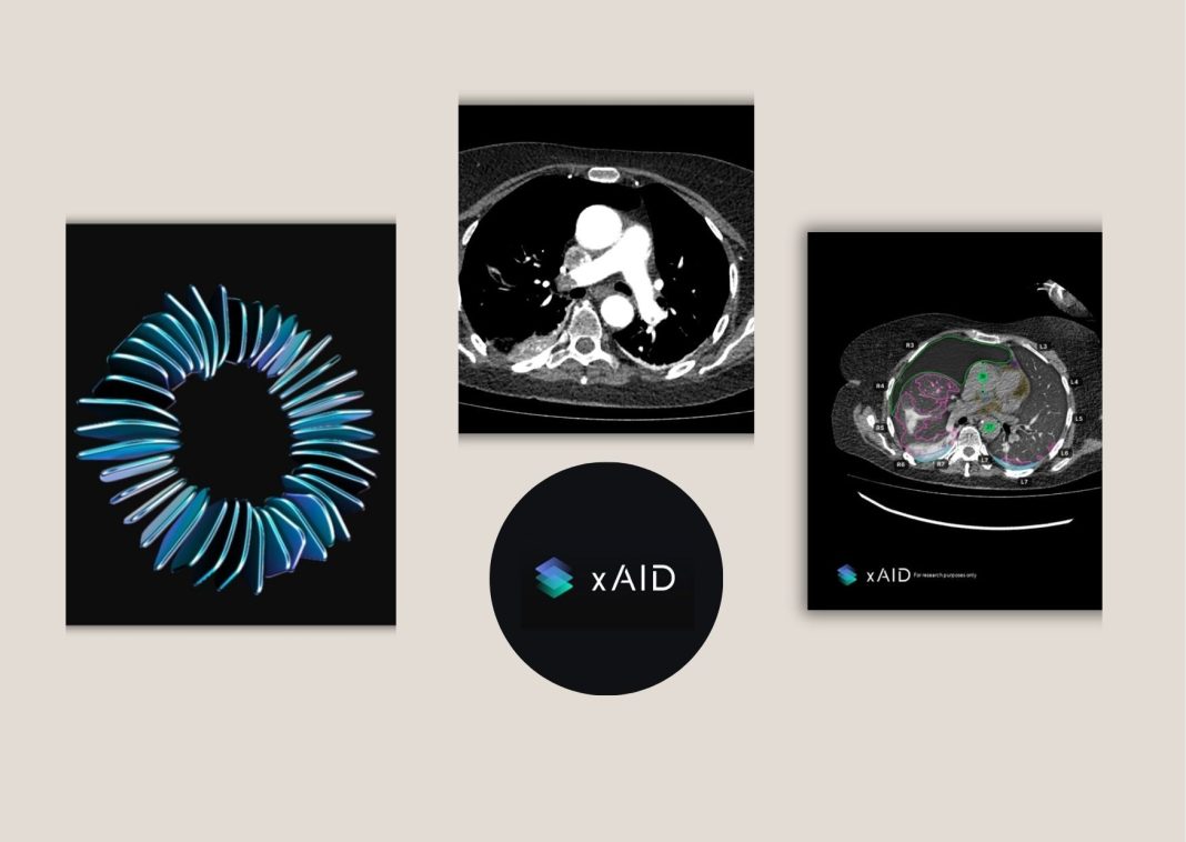 Choosing the Right Teleradiology Provider for Scale