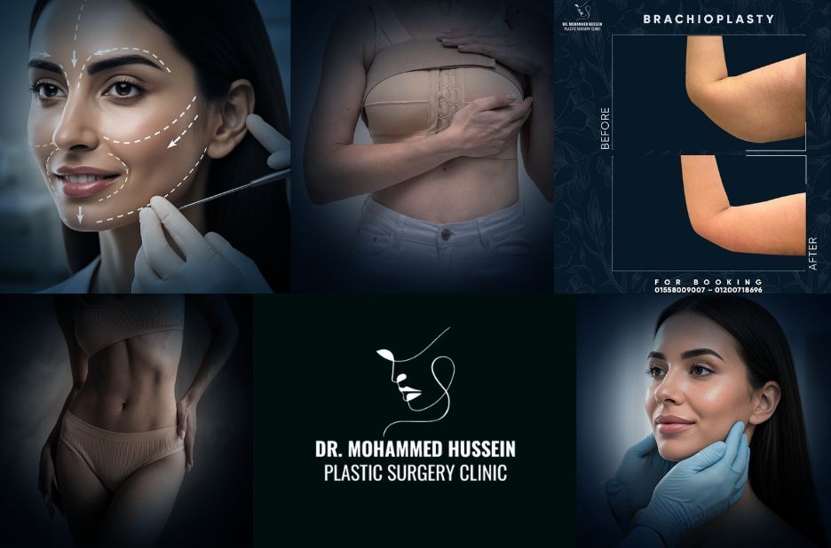 دليل شامل لتجميل الأنف في مصر قبل الجراحة وبعدها